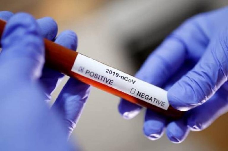 RDC – Coronavirus: un Congolais résidant en France ramène la maladie à Kinshasa