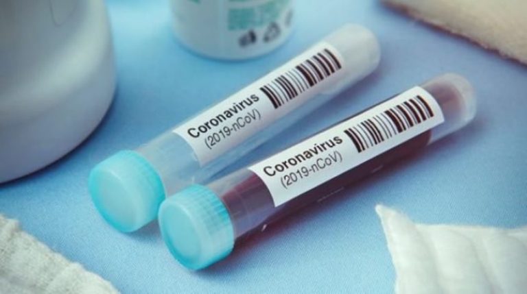 Coronavirus au Nigéria : le bilan de la pandémie ce 22 juillet