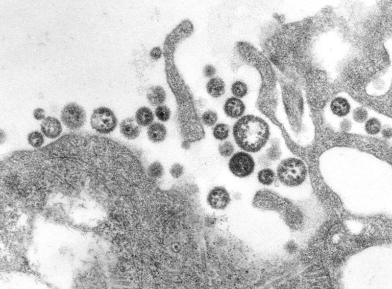 Bolivie: la réapparition d&rsquo;un étrange et mortel virus inquiète les scientifiques