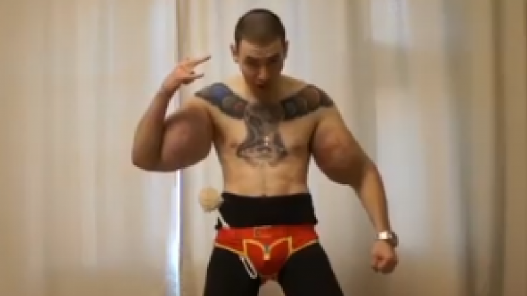 Russie: il s&rsquo;injecte un produit dangereux et risque de perdre ses deux bras